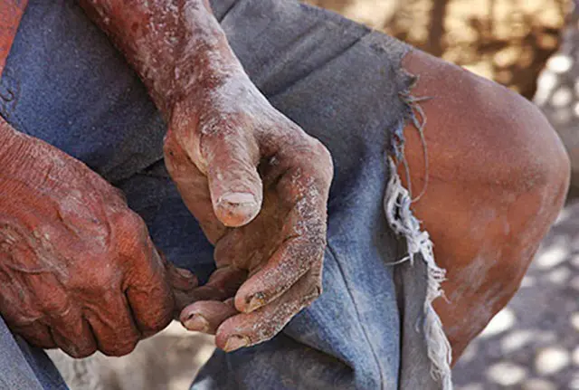 Mais de 217 mil tocantinenses saíram da pobreza e 51 mil da extrema pobreza nos últimos anos no TO; Governador repercute números