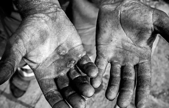 Aprovado Plano  Estadual para a Erradicação do Trabalho Escravo no Estado - Foto: Freepik
