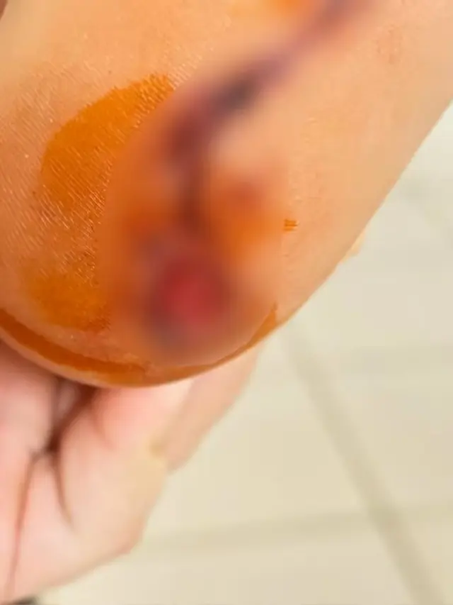 Menino ficou ferido após ataque de piranha — Foto: Arquivo Pessoal