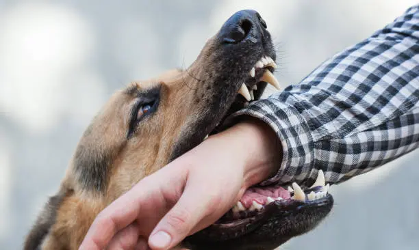 One German shepherd bites a man by the hand. Training and breeding thoroughbred dogs. One German shepherd bites a man by the hand. Training and breeding thoroughbred dogs.