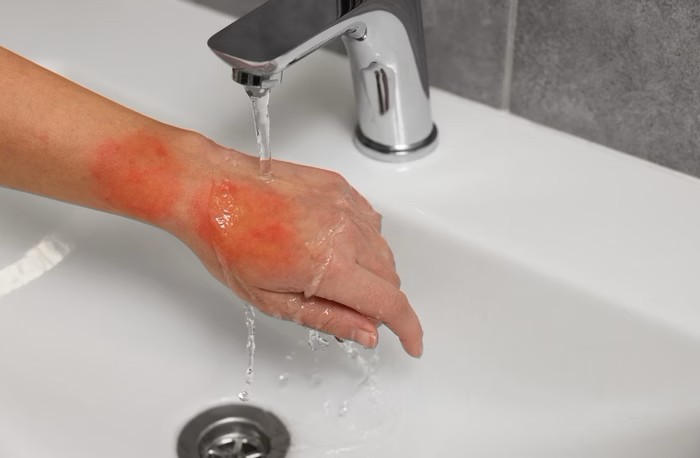 Foto: Liudmila Chernetska/Getty Images Foto: Liudmila Chernetska/Getty Images