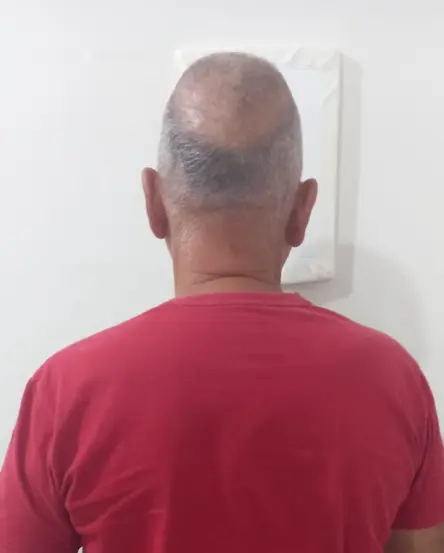  Homem foi preso após ação da equipe da 2ª DAV de Araguaína - Foto: DICOM SSP TO 