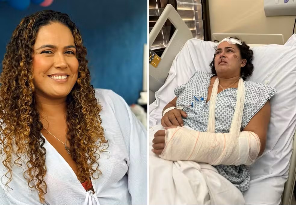 Vítima teve braço e dentes quebrados após ser agredida enquanto dormia — Foto: Arquivo Pessoal/Lorrany Evangelista Vítima teve braço e dentes quebrados após ser agredida enquanto dormia — Foto: Arquivo Pessoal/Lorrany Evangelista