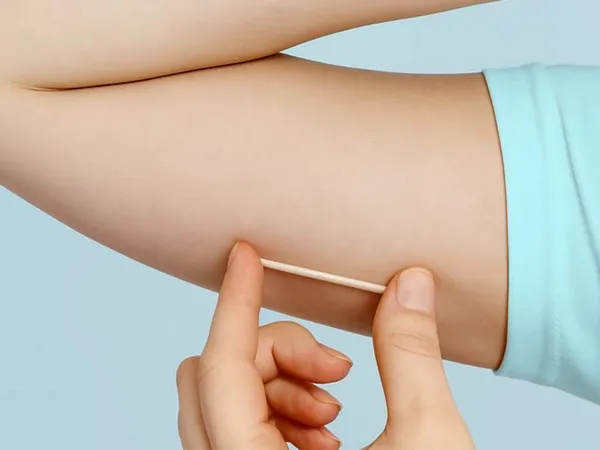 Foto: Divulgação Foto: Divulgação