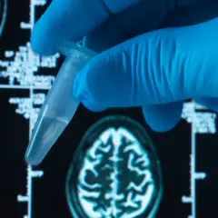 Foto: Westend61/Getty Images