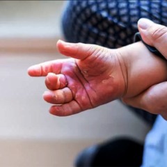 F&eacute;rias e calor acendem alerta no Tocantins: 44 crian&ccedil;as pequenas foram internadas por queimaduras s&oacute; este ano