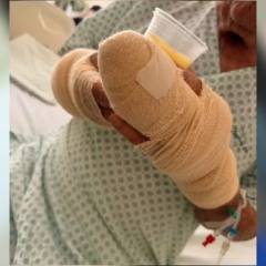 Idoso fica gravemente ferido ap&oacute;s ser atacado por pitbull em Palmas