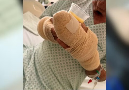 Idoso fica gravemente ferido após ser atacado por pitbull em Palmas