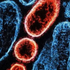 A &Iacute;ndia enfrenta novo surto do v&iacute;rus Nipah, pat&oacute;geno com alto &iacute;ndice de letalidade que tem afetado pa&iacute;ses na &Aacute;sia &mdash; Foto: Universal Images Group/Getty Images