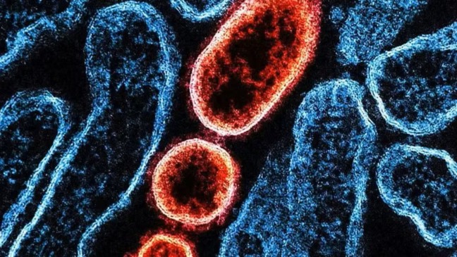 A Índia enfrenta novo surto do vírus Nipah, patógeno com alto índice de letalidade que tem afetado países na Ásia — Foto: Universal Images Group/Getty Images