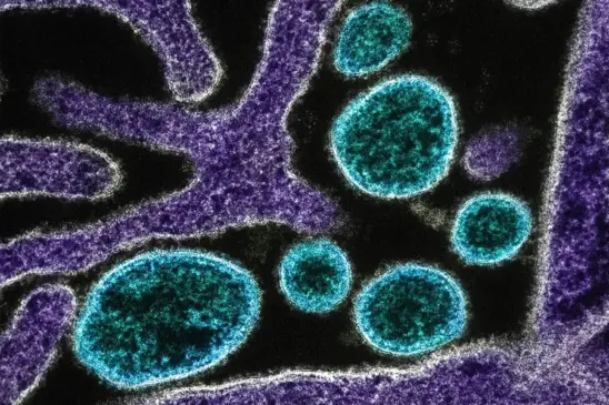 
National Institute of Allergy and Infectious Diseases/Unsplash