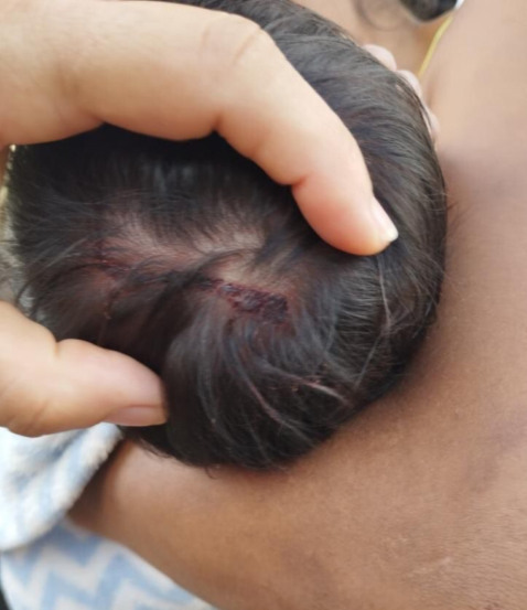 Bebê de 25 dias é atingido na cabeça durante ataque do pai à mãe, no norte do Tocantins