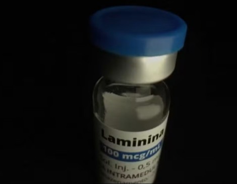 Estudo da polilaminina apontam que proteína pode ajudar a devolver movimentos para quem tem lesões na medula — Foto: Reprodução/TV Globo