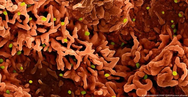 Partículas do vírus mpox (em verde) sobre células infectadas. Disseminação do patógeno ainda preocupa especialistas. — Foto: NIH-NIAID/IMAGE POINT FR/BSIP/picture alliance