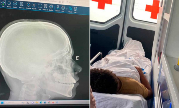 O episódio ocorreu no Colégio Estadual João D’Abre, em Dianópolis / Foto: Montagem - Reprodução
