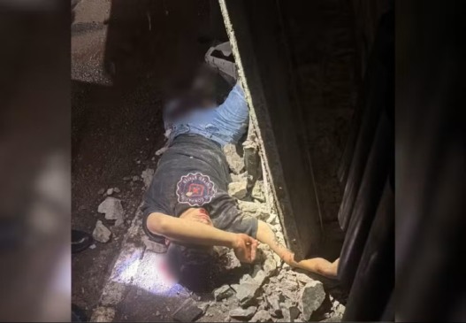 Adolescente fraturou as duas pernas após ser atropelado por viatura da PM, em Alvorada (TO) — Foto: Arquivo Pessoal