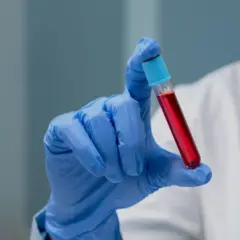 
Foto: Exame de sangue pode ajudar a detectar hansen&iacute;ase mais cedo - Foto: Freepik