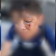 Agress&atilde;o aconteceu na &uacute;ltima segunda-feira (30) durante o hor&aacute;rio de aula em Dian&oacute;polis &mdash; Foto: Reprodu&ccedil;&atilde;o/Arquivo pessoal de Hemily Guimar&atilde;es