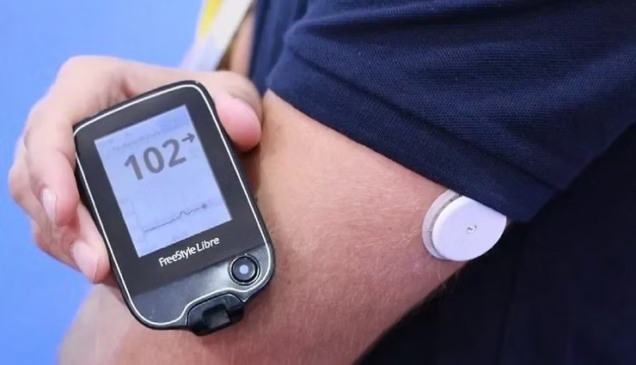 Crianças e adolescentes com diabetes tipo 1 vão receber sensores de glicose em Palmas